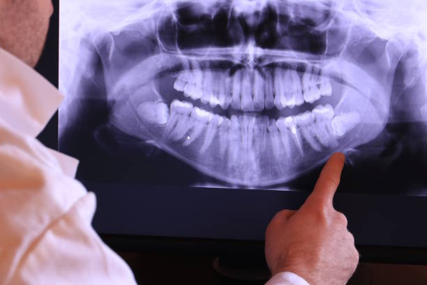 Best Emergency TMJ Treatment in Herriman, UT